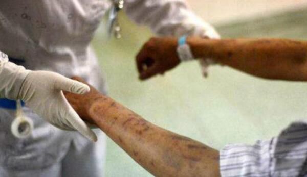 ������������˹��˭ ������������˹��״��ô����