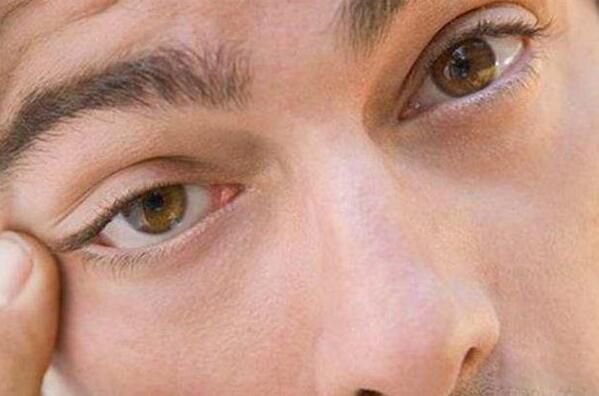 ����Ƥ���˼���������ô���� ����Ƥ����ʲôԤ���Ǹ��ǻ�