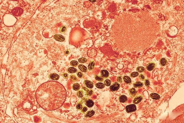 �컨������ô������� ������컨��������һ�걬����