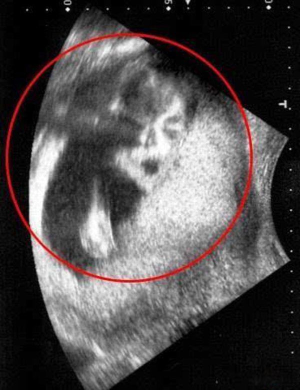 诡异事件真人真事 照片上鬼影竟是42年前的自己感到毛骨悚然