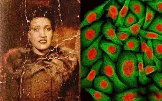 ����ϸ����ʲôϸ�� ��������5000����������