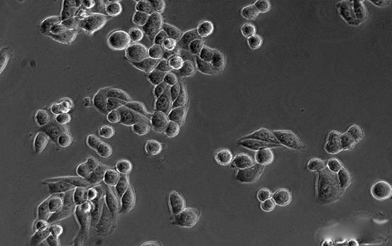 ����ϸ����ʲôϸ�� ��������5000����������