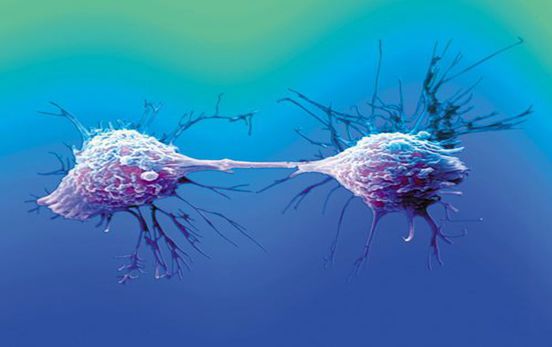 ����ϸ����ʲôϸ�� ��������5000����������