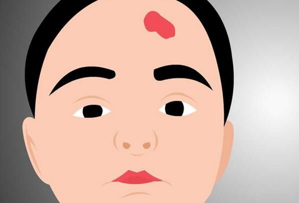 ��ɫ̥������ô���� ��ɫ̥�ǵĴ�˵Ԣ��