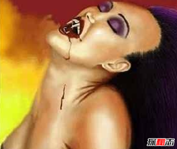 Blaschko����֢��ʲô�� �����������Ĺֲ�֢