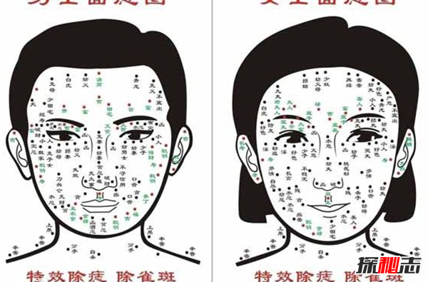 取痣图哪些痣必须取 十大凶痣都长在什么位置