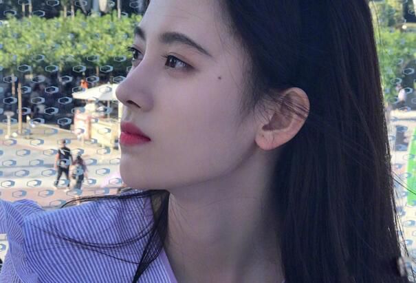 血痣和红痣的区别图片 脸上有红痣面相好不好