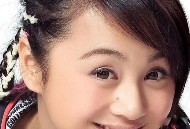 血痣和红痣的区别图片 脸上有红痣面相好不好