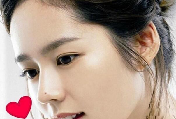 血痣和红痣的区别图片 脸上有红痣面相好不好