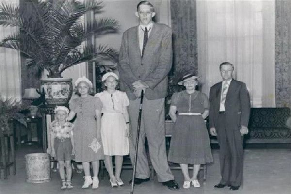 罗伯特沃德洛身高2.72米得了什么病 罗伯特沃德洛的身高增长过程