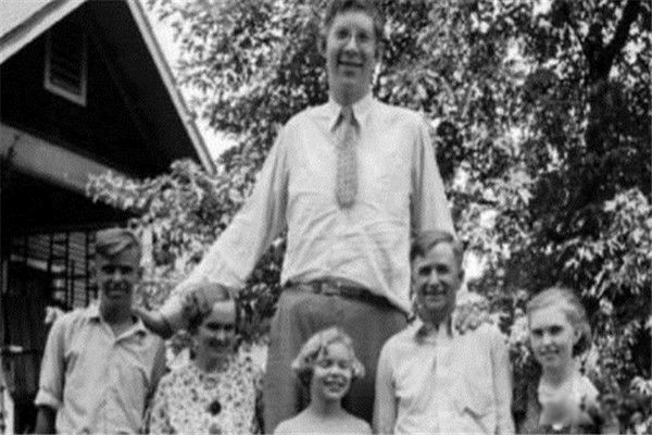 罗伯特沃德洛身高2.72米得了什么病 罗伯特沃德洛的身高增长过程