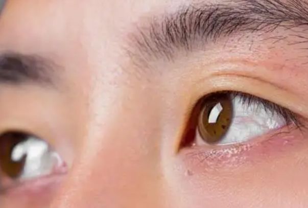 左眼跳是什么预兆 二十四小时左眼跳吉凶预兆