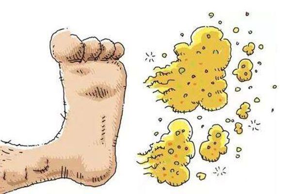 ��۽�ָ����ʲô ��۽ŵ�����,����Щ֢״