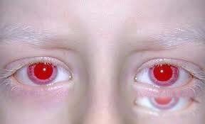 ��ϡ�е��۾���ɫ������ʲô ��ɫ�۾���ʲô����