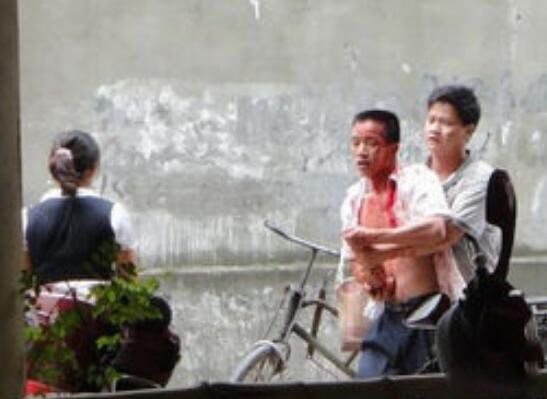 飙血哥事件真相详细介绍 飙血哥是什么人