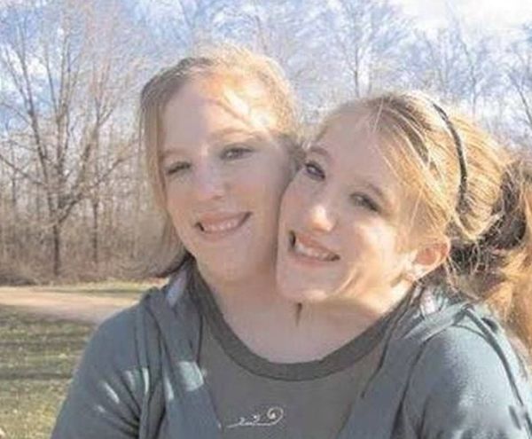 ����˫��̥����ô�γɵ� ����˫��̥����������