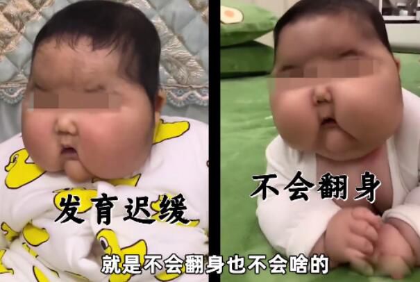 女婴抹婴儿霜变"大头娃娃" 如何看待婴儿霜大头娃娃事件