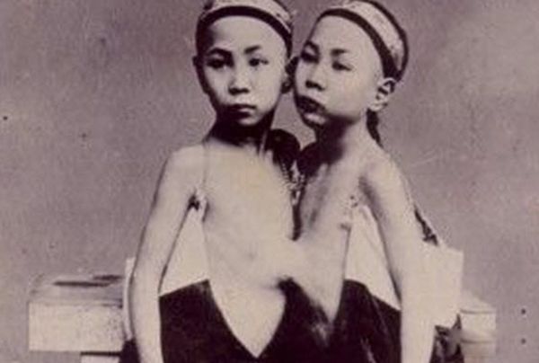 ����˫��̥����ô�γɵ� ����˫��̥����������