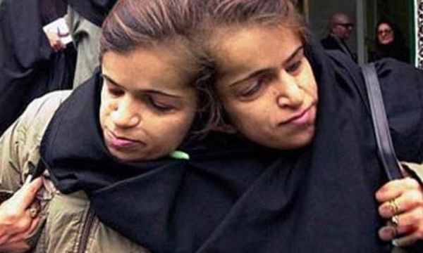 ����˫��̥����ô�γɵ� ����˫��̥����������