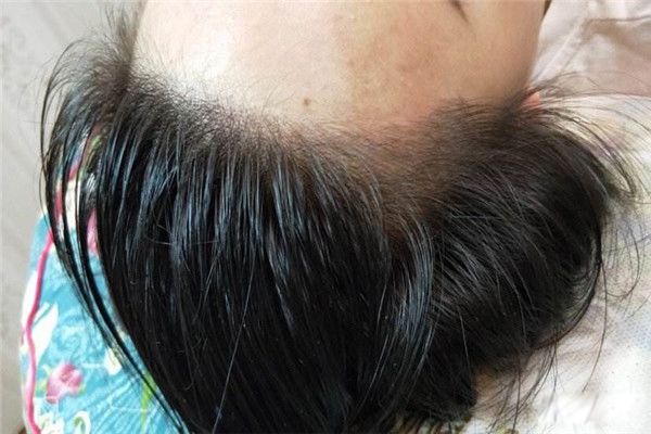 �Ʒ����ߺ���� �Ʒ�������ʲôΣ����