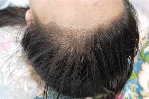 �Ʒ����ߺ���� �Ʒ�������ʲôΣ����