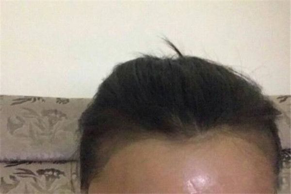 �Ʒ����ߺ���� �Ʒ�������ʲôΣ����