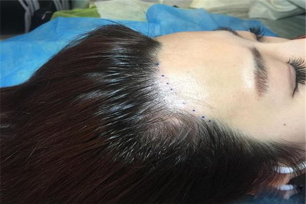 �Ʒ����ߺ���� �Ʒ�������ʲôΣ����