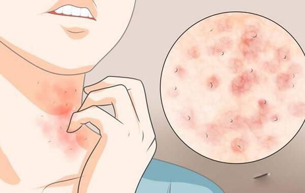 ����ҧ�ĸ���ͼƬ ����ҧ����ʲô����ͼ