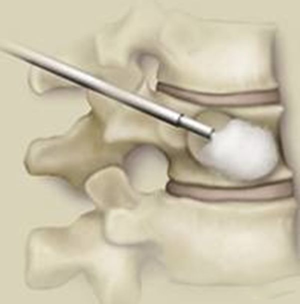 ����������֮����ʲô �й������˵��¼���ʵ����