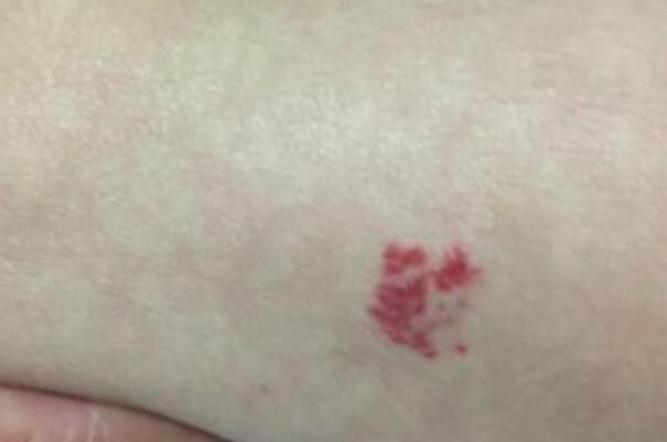 ̥�ǳ��������и��� ̥�������岻ͬ��λ����ʲô