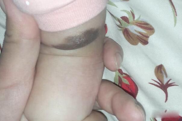 ̥�ǳ��������и��� ̥�������岻ͬ��λ����ʲô