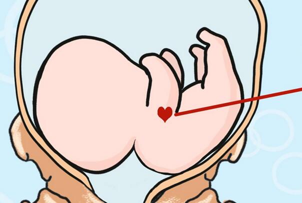 ��ɫ̥�Ǵ���ʲô��˼ ��ɫ̥����ʲôԢ�������