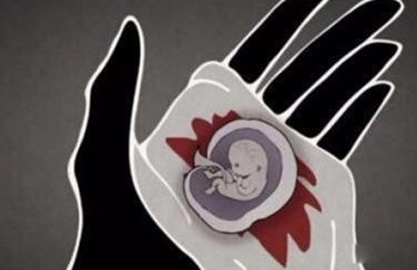 ��̥�Ĺ����뻯�ⷽ������ ��̥�ĺ���ȥ������