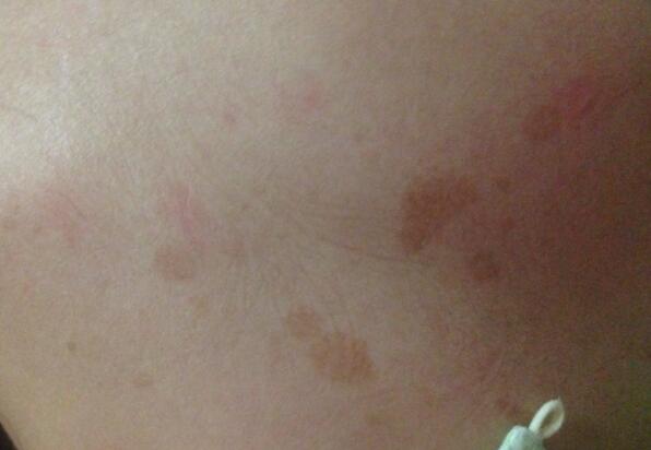 ��ɫ̥�ǵ�λ�������� ��ɫ̥�Ǵ���ʲôԤ��