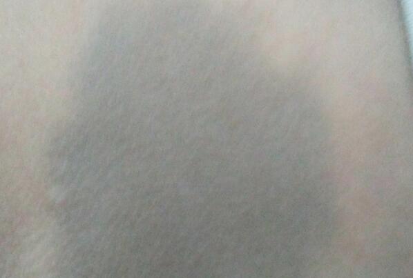 ��ɫ̥�ǵ�λ�������� ��ɫ̥�Ǵ���ʲôԤ��