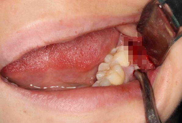 ���ǳݻ������ һ�ΰ������ǳݻ��۵�����Щ��