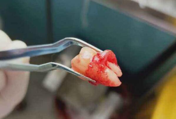 ���ǳݻ������ һ�ΰ������ǳݻ��۵�����Щ��