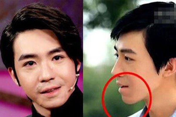 �μ���Ϊʲô�޾���������� ��ͬ��������ȴ���˳���