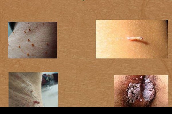 Ҹ�³��˸�С����ͼƬ ����������۵Ļ���������ά��