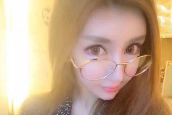 斗鱼王瑞儿整容前照片 整容脸变残