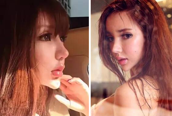 斗鱼王瑞儿整容前照片 整容脸变残