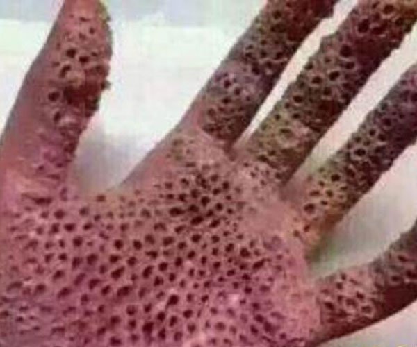 �����к�ԭͼ�ֲ���Ƭ ʮ������������ǲ������