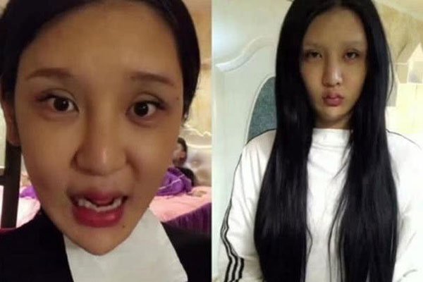 桃花宝宝原本长相 16岁整容前照片现在怎么样了