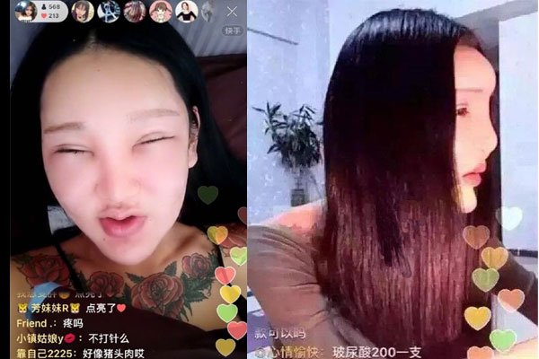 桃花宝宝原本长相 16岁整容前照片现在怎么样了