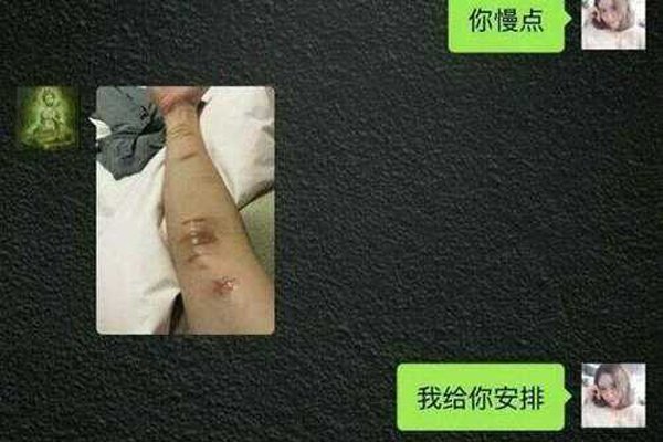 �������ֱ�ȥ������ �����˺�Ҳ����Ϳ�ʼ��