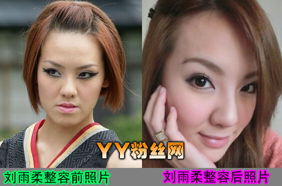 ����������������Ƭ��ǿ�� ����������ǰ����Ƭ�Ա�