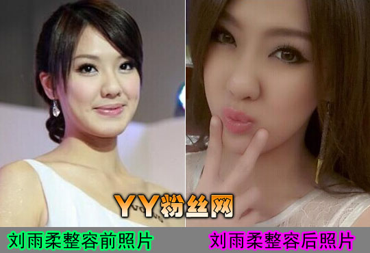 ����������������Ƭ��ǿ�� ����������ǰ����Ƭ�Ա�