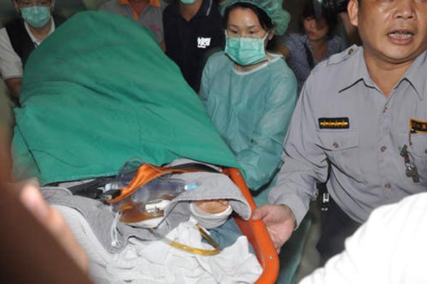 任家萱烧伤前后对比照 大面积留疤恐怖到丈夫都嫌弃