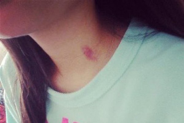 什么情况下男女种草莓 女生主动给男生种草莓怎么种种哪里