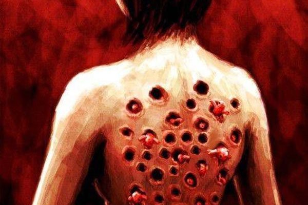 玉米男孩寄生虫子图片 请帮我找一下玉米男孩的图片